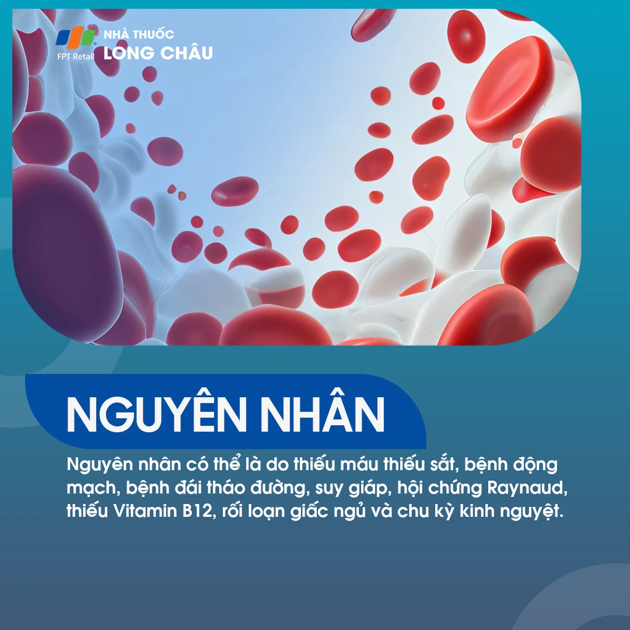 Hình ảnh minh họa