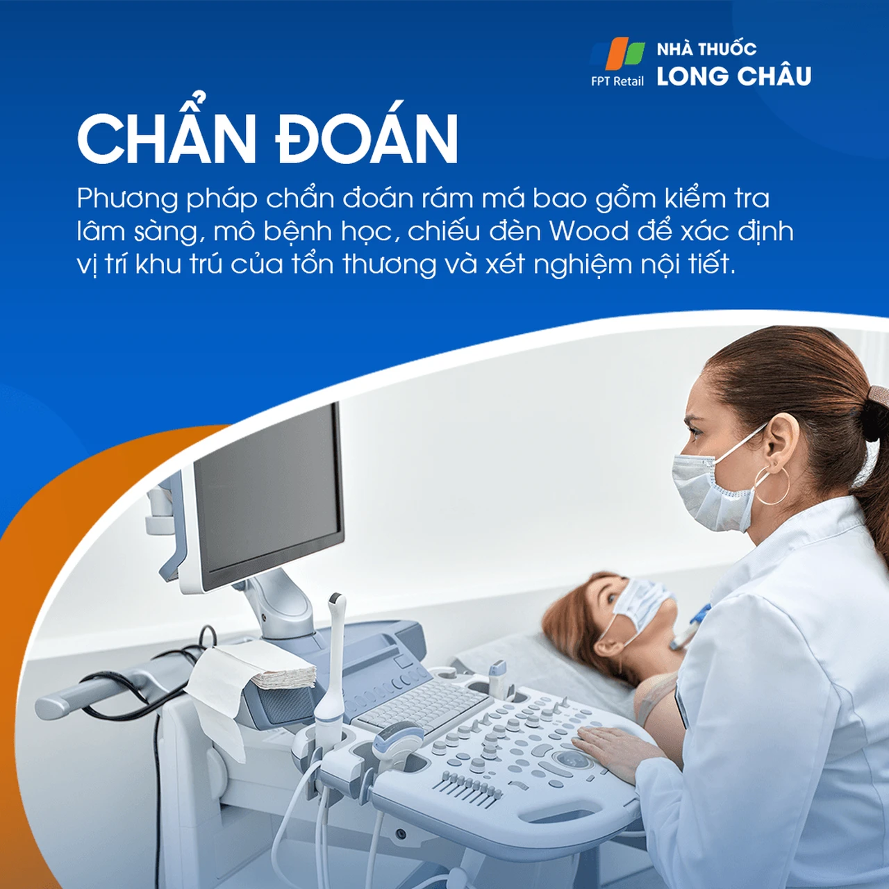 Hình ảnh minh họa