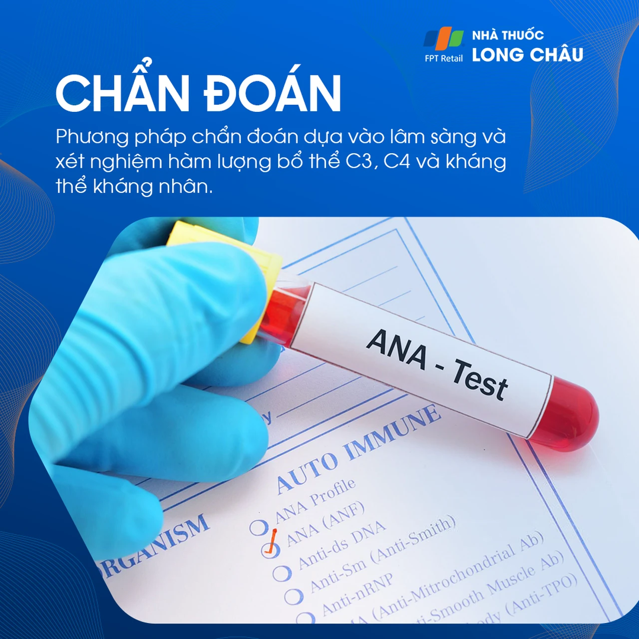 Hình ảnh minh họa