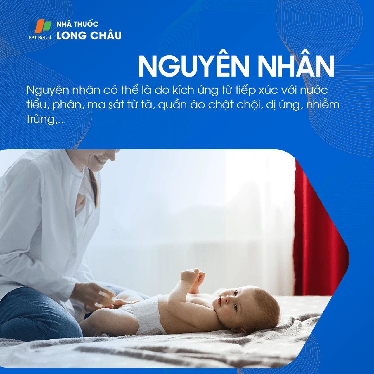 Hình ảnh minh họa