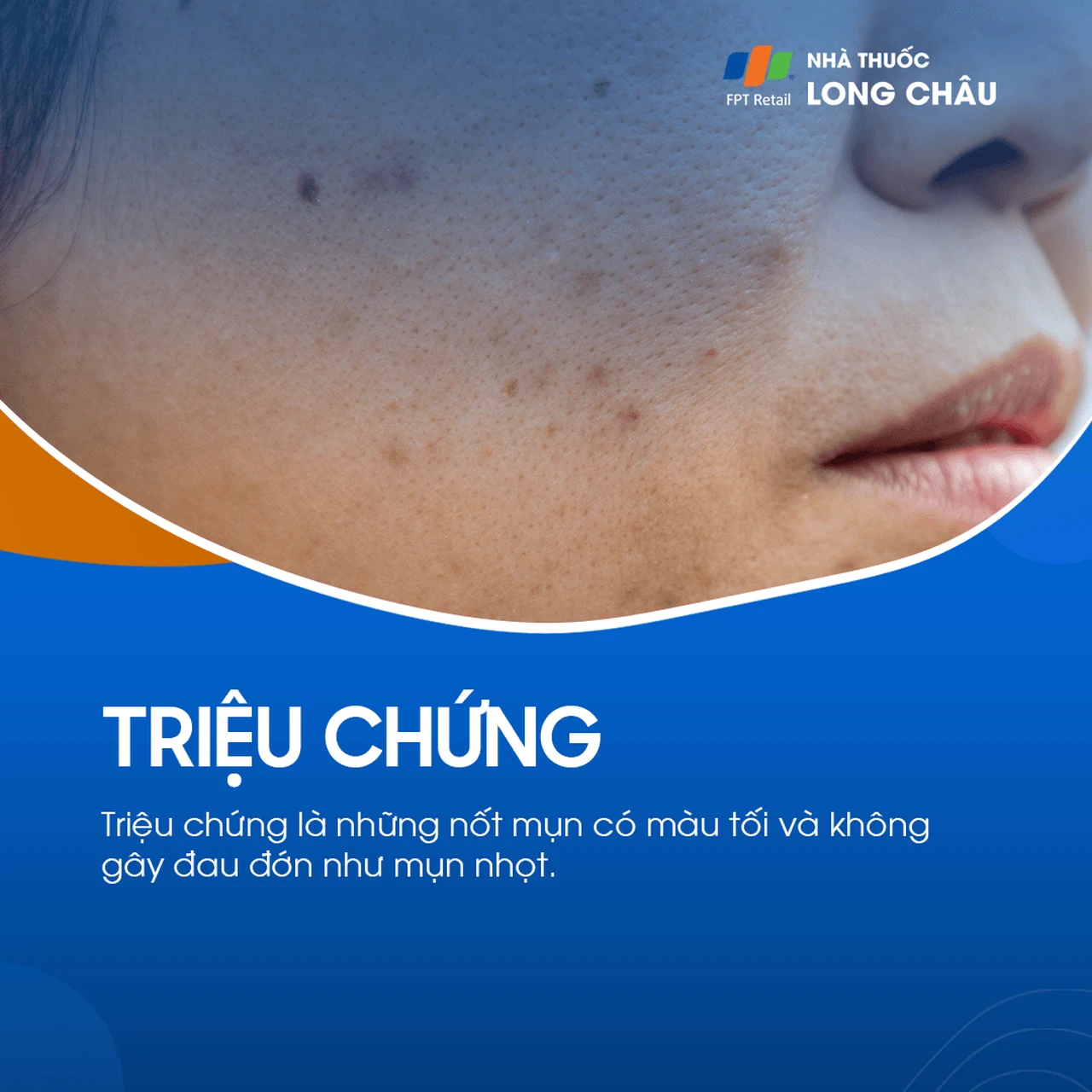 Hình ảnh minh họa