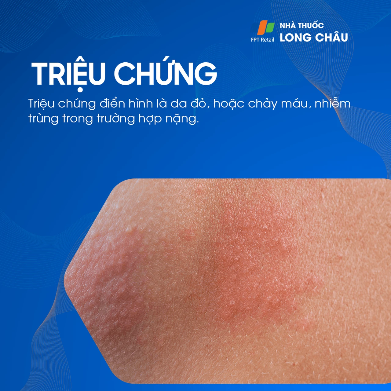 Hình ảnh minh họa