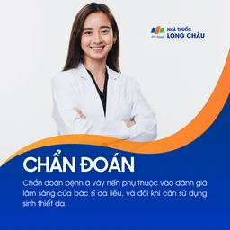 Hình ảnh minh họa