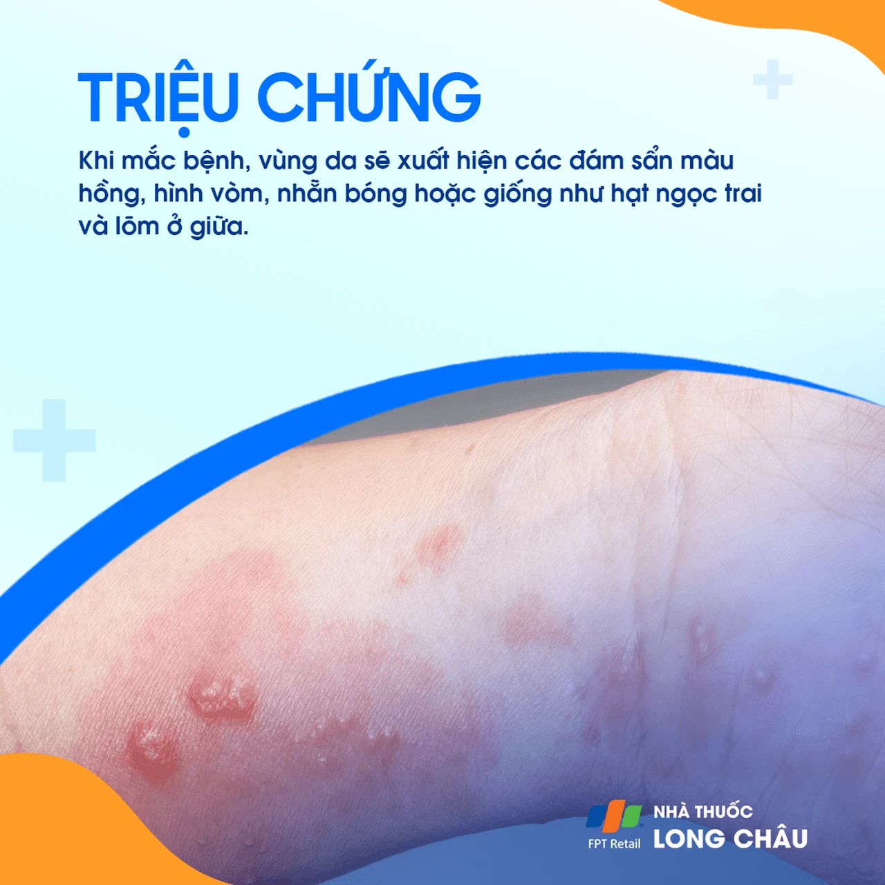 Hình ảnh minh họa