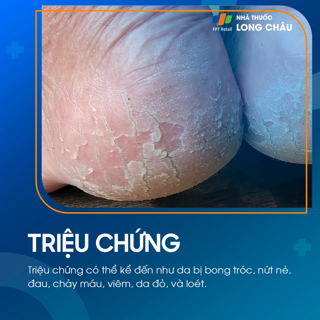 Hình ảnh minh họa