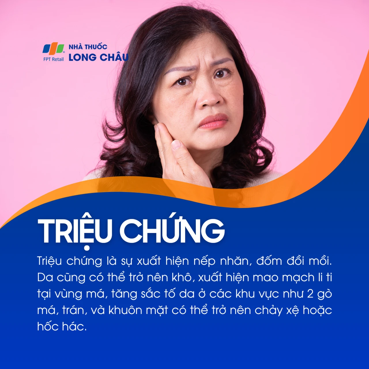 Hình ảnh minh họa
