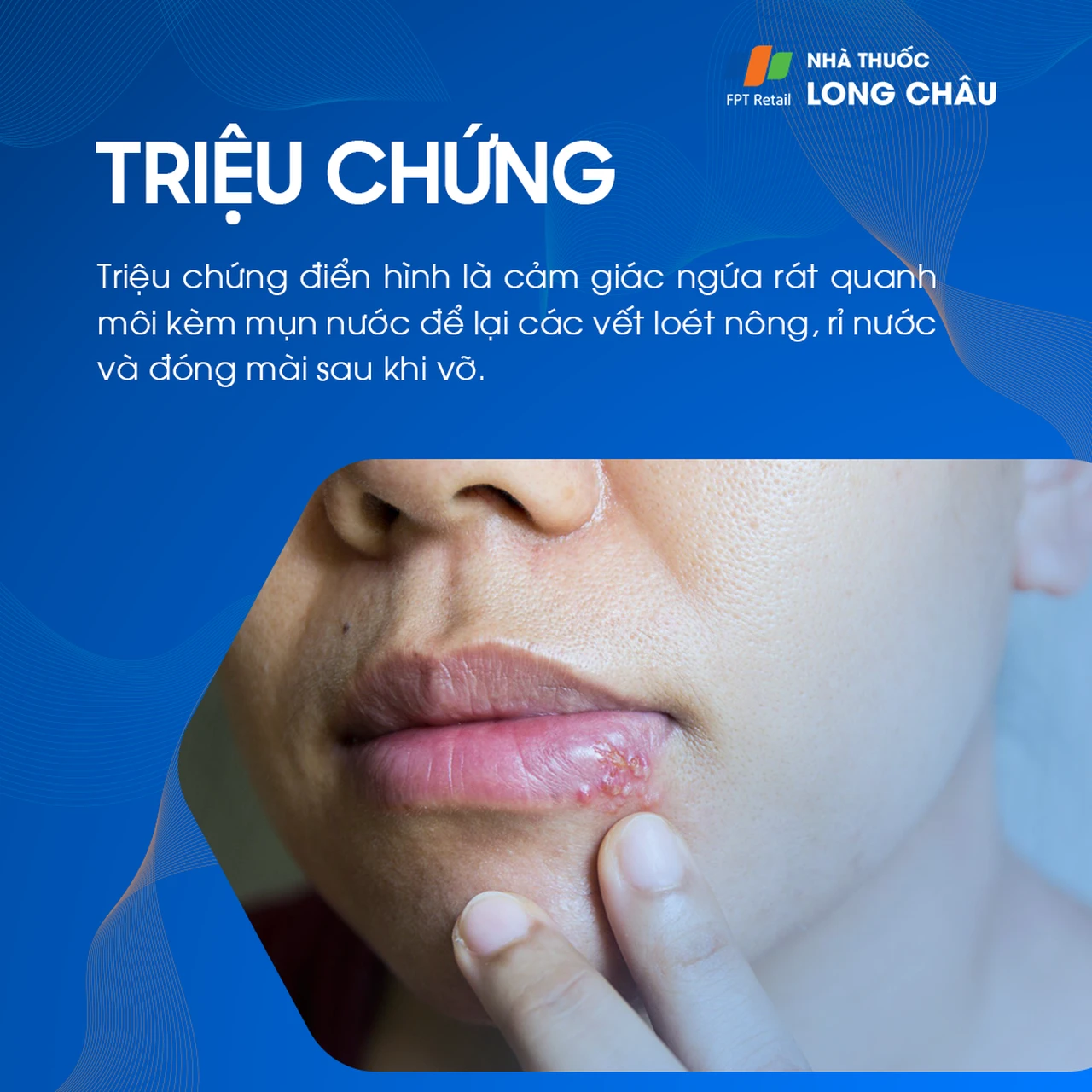 Hình ảnh minh họa