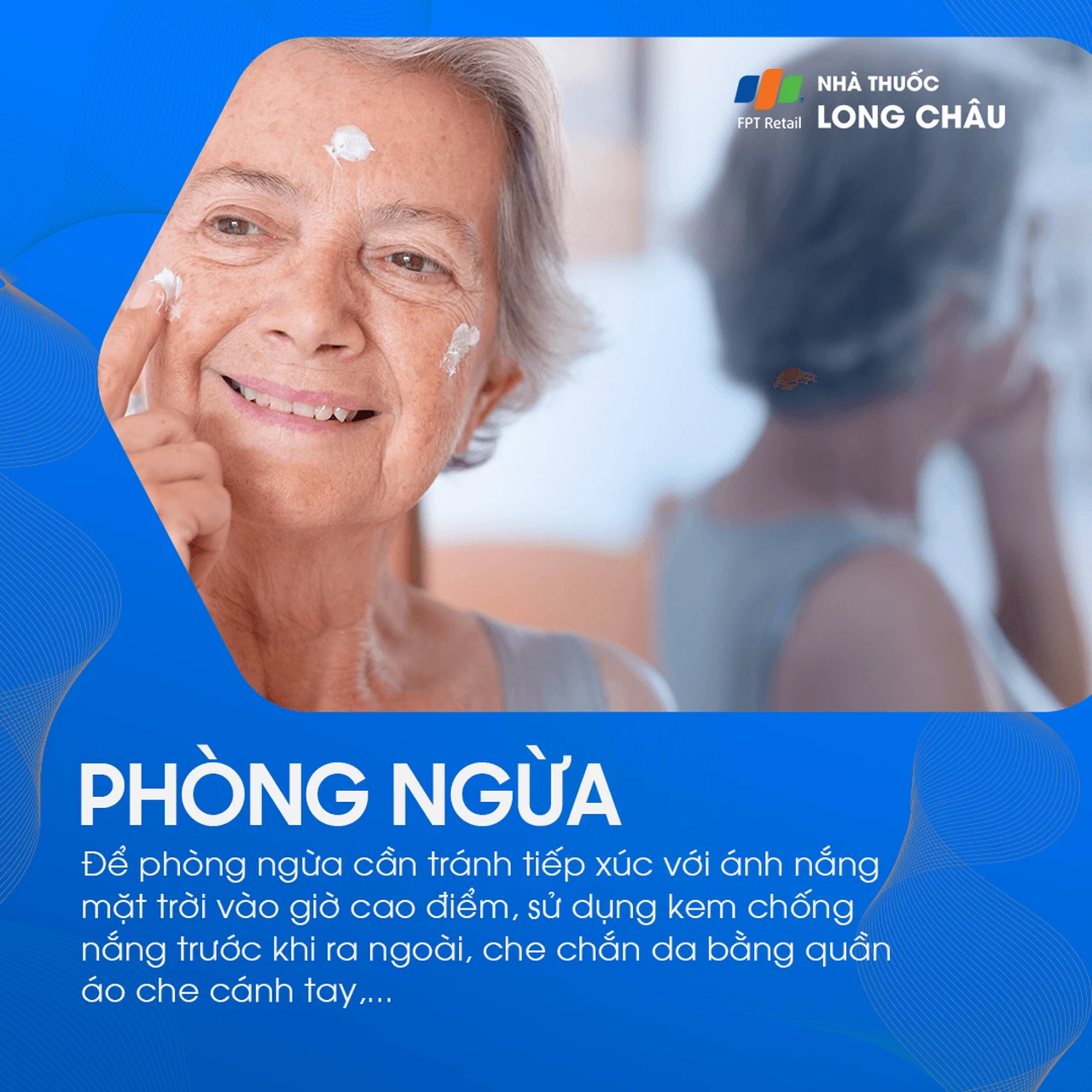 Hình ảnh minh họa
