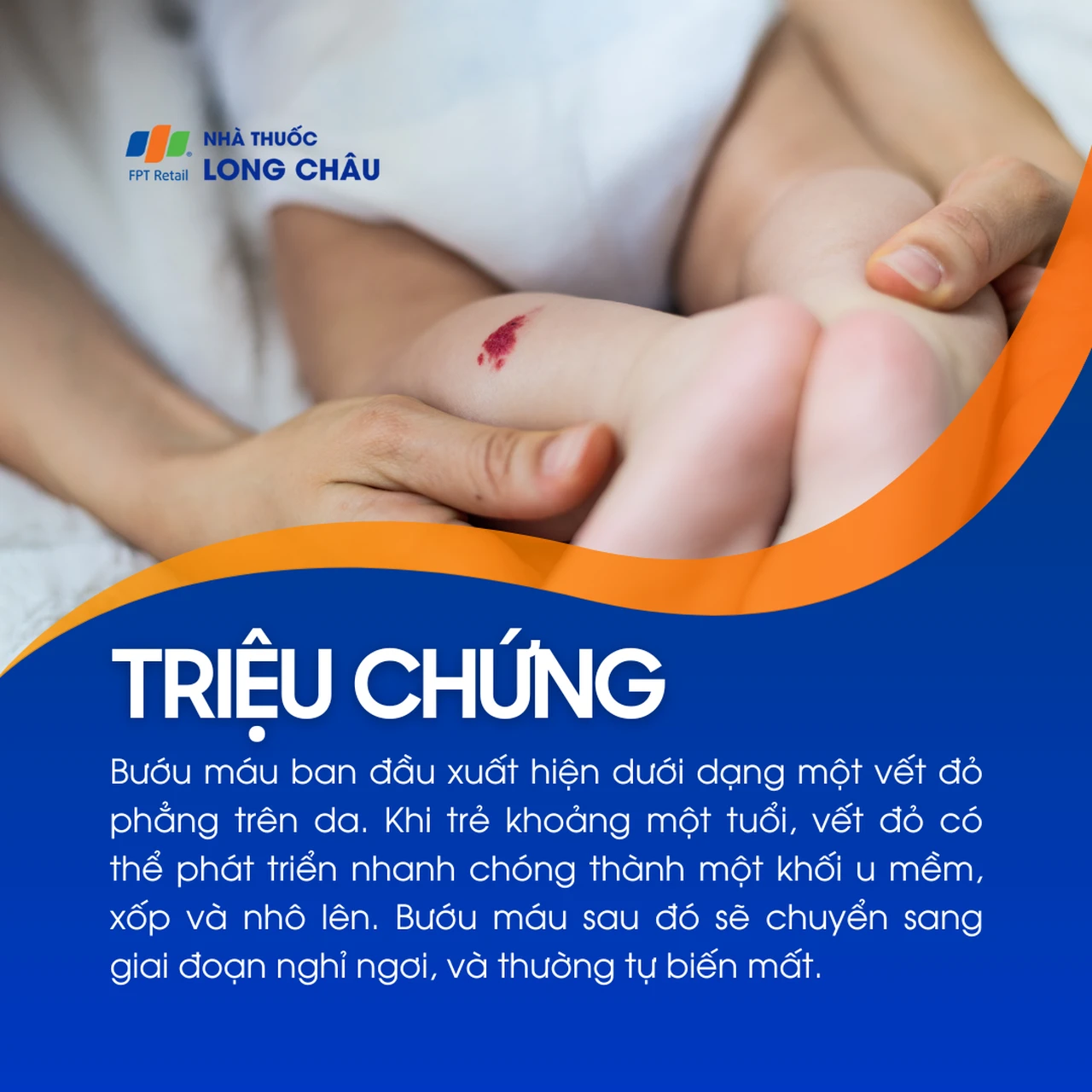 Hình ảnh minh họa