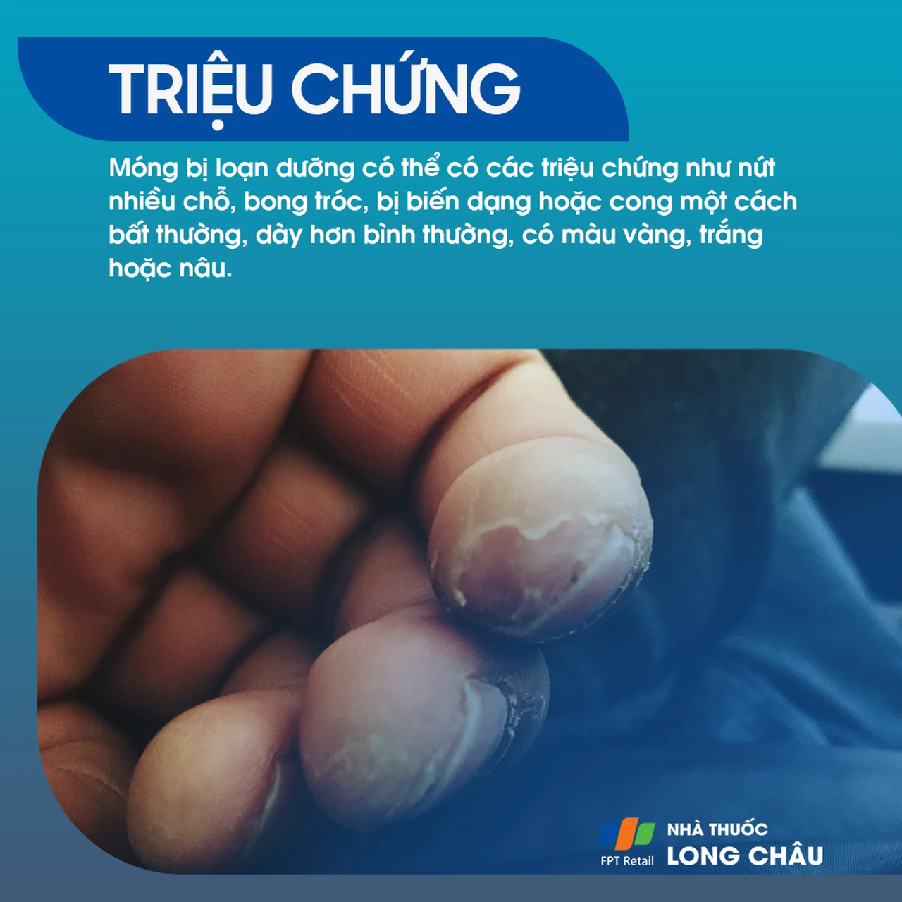 Hình ảnh minh họa