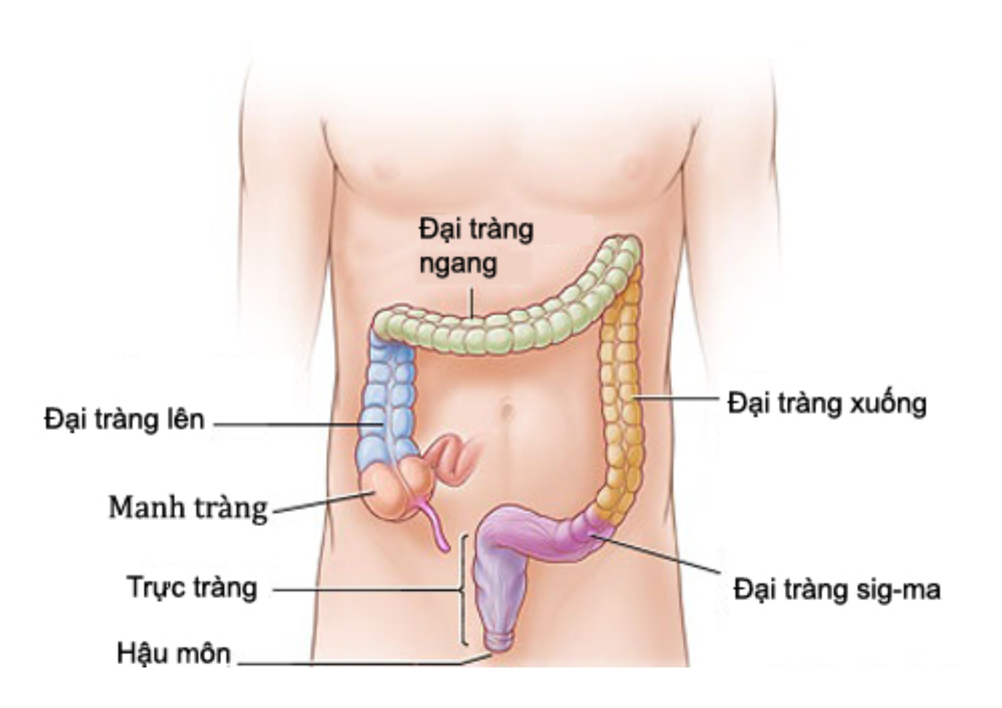 Ung thư ruột kết là gì? Những điều cần biết về ung thư ruột kết