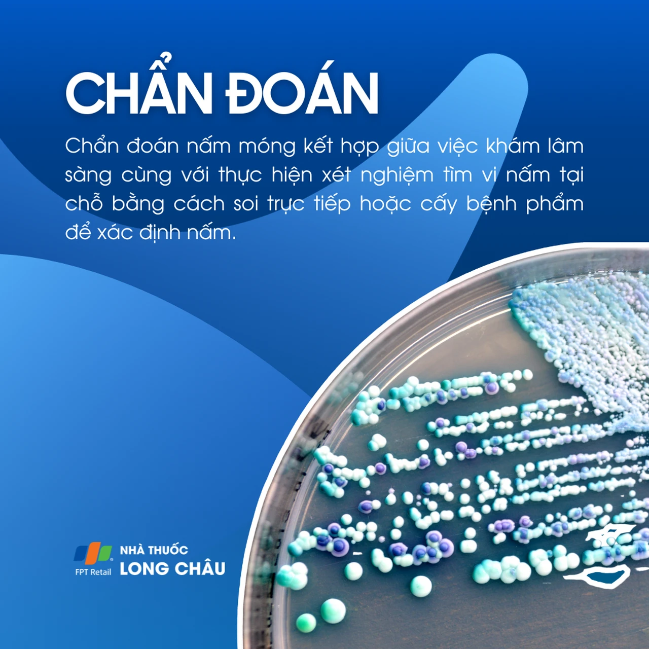 Hình ảnh minh họa