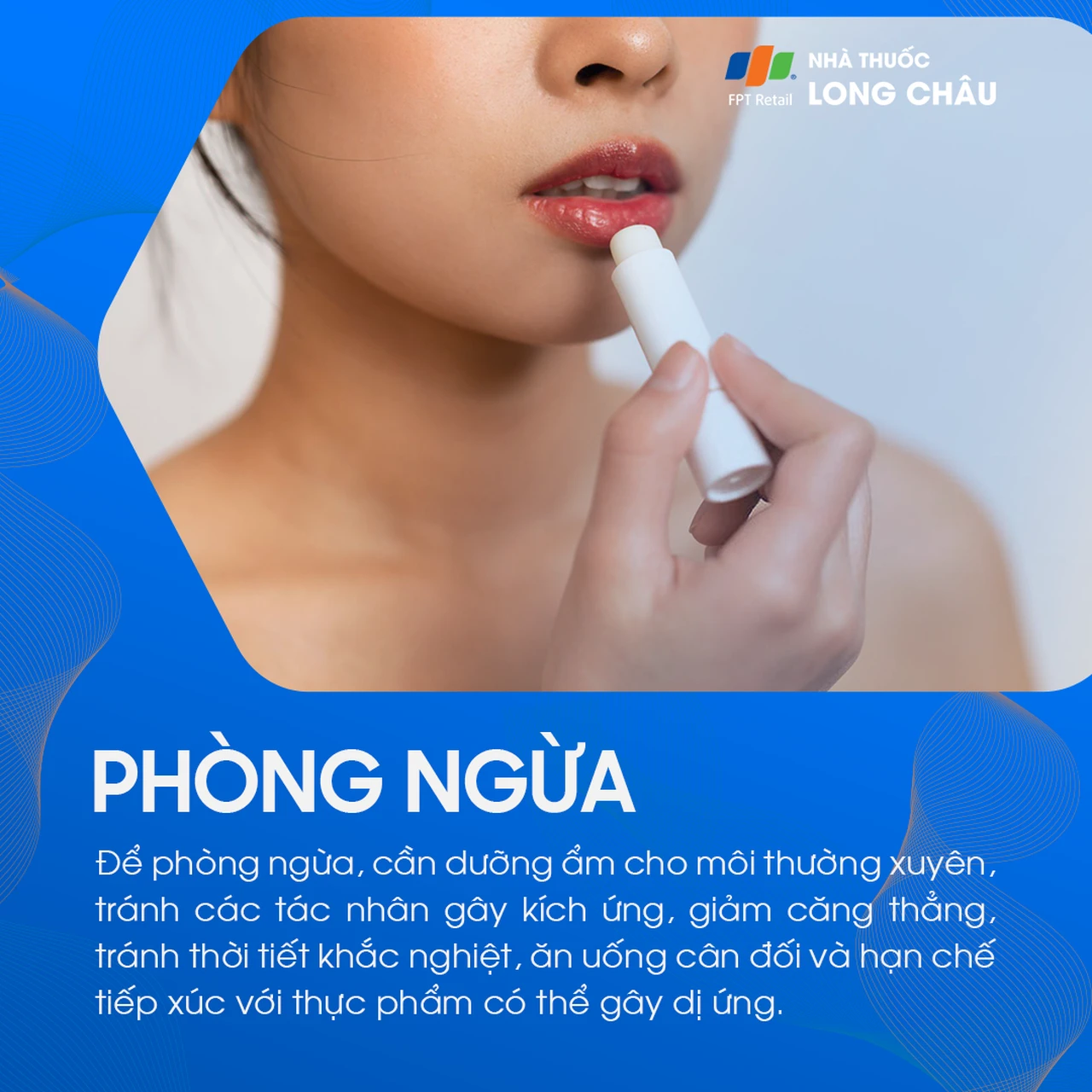 Hình ảnh minh họa