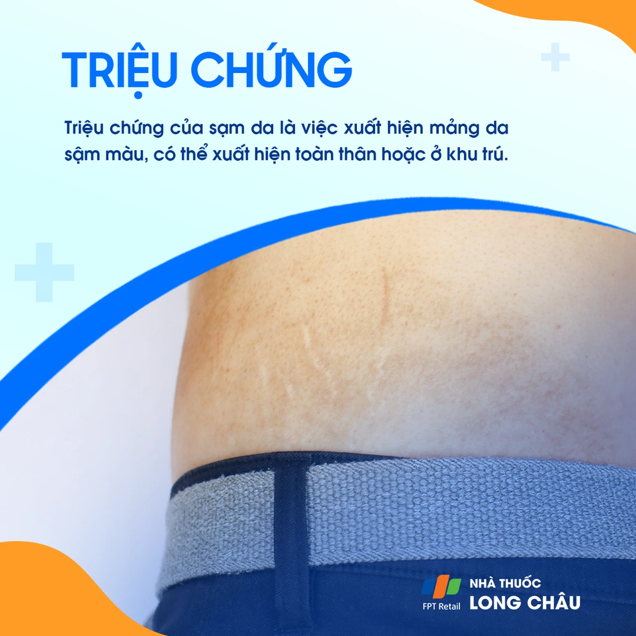 Hình ảnh minh họa