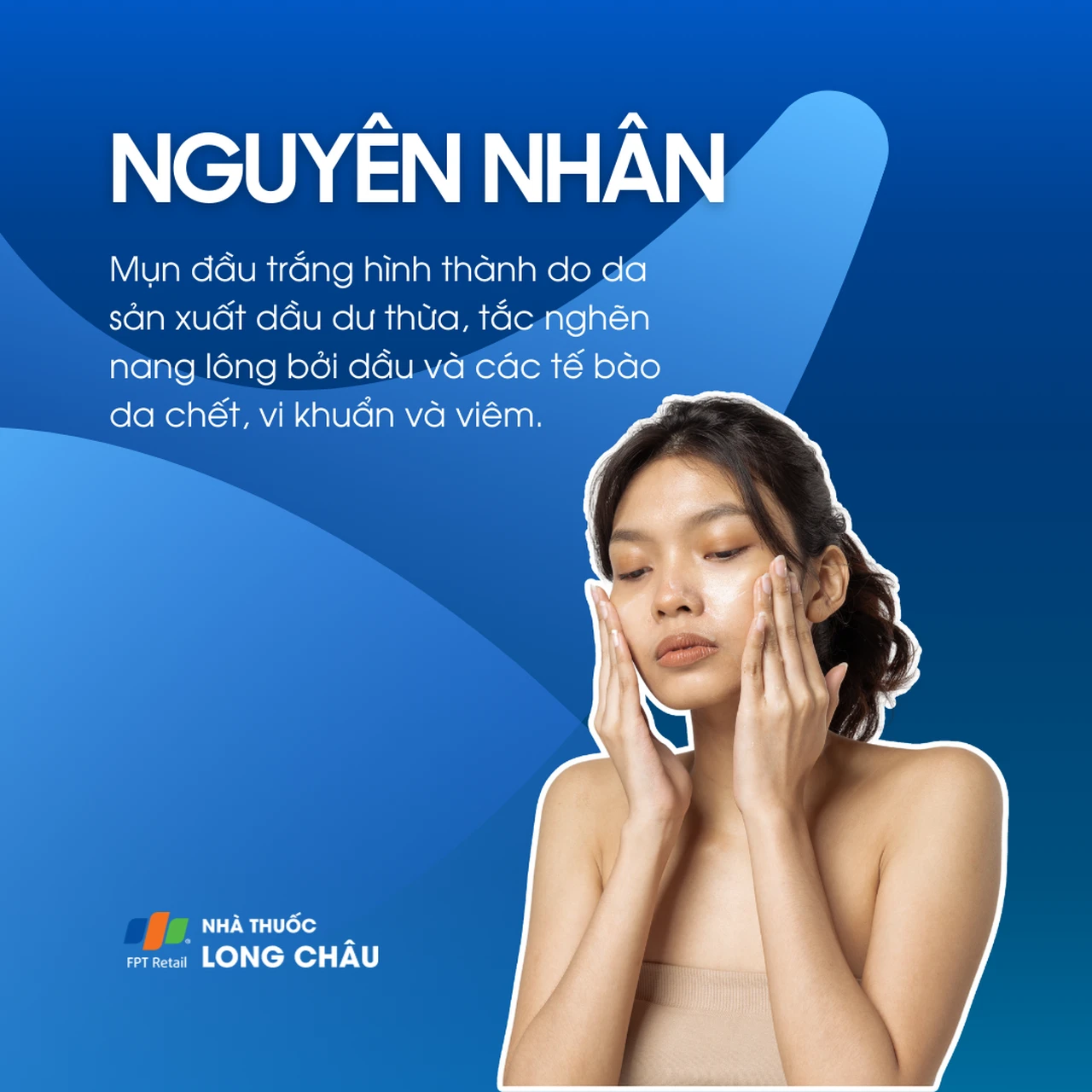 Hình ảnh minh họa