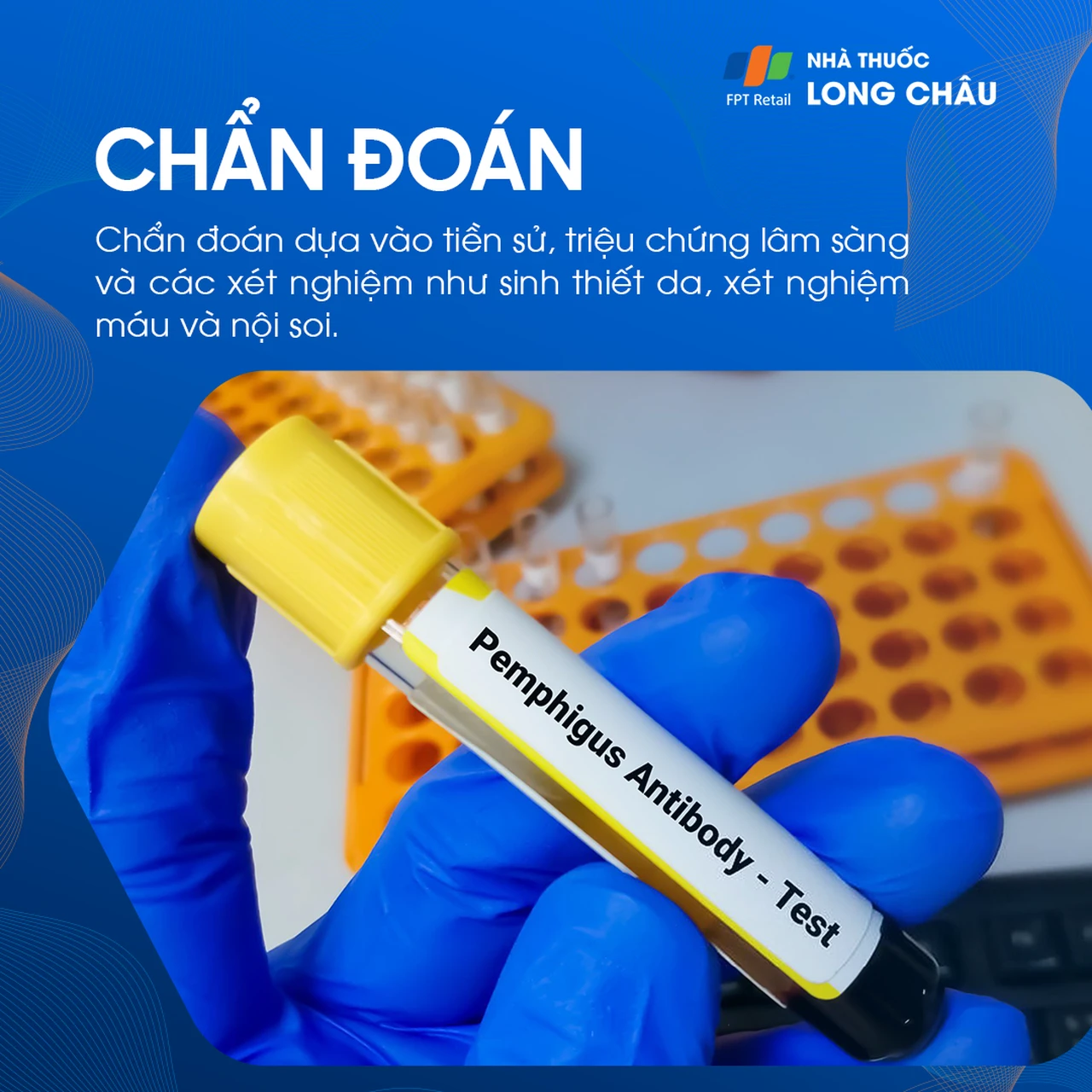 Hình ảnh minh họa
