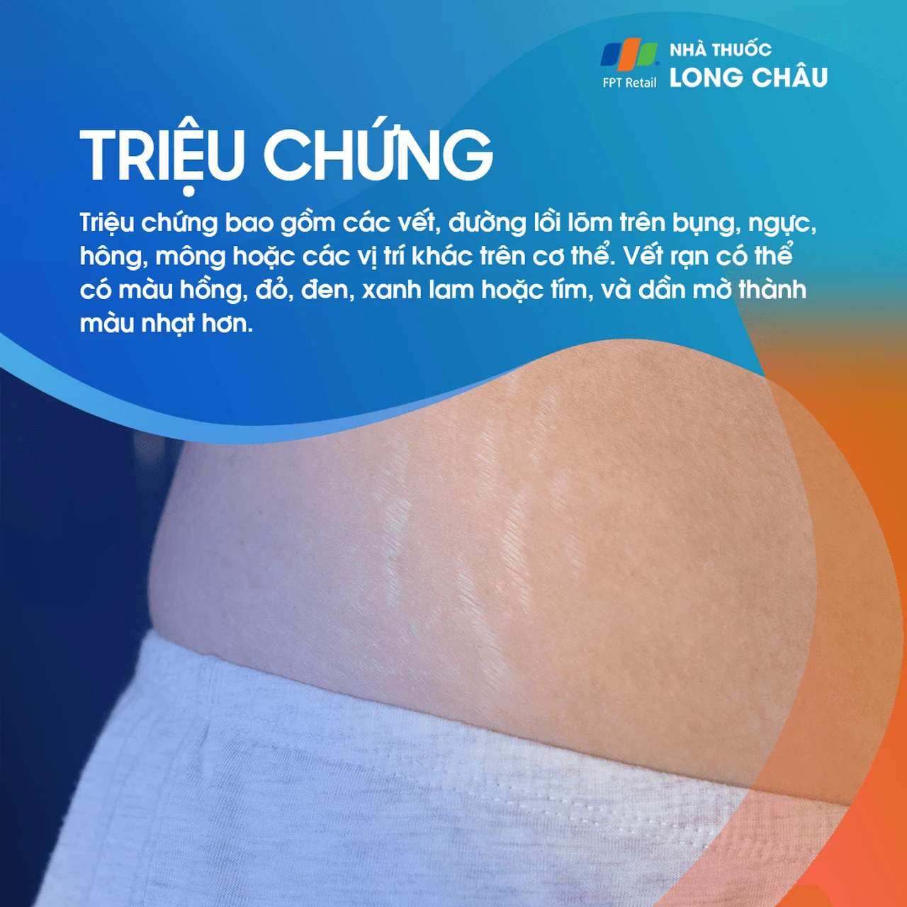 Hình ảnh minh họa