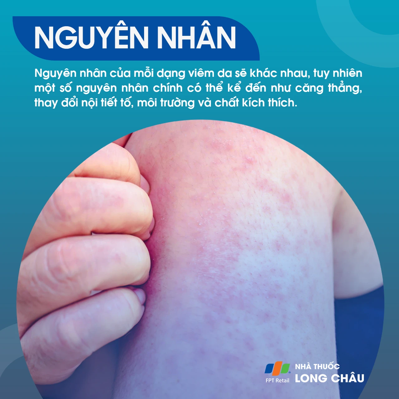 Hình ảnh minh họa