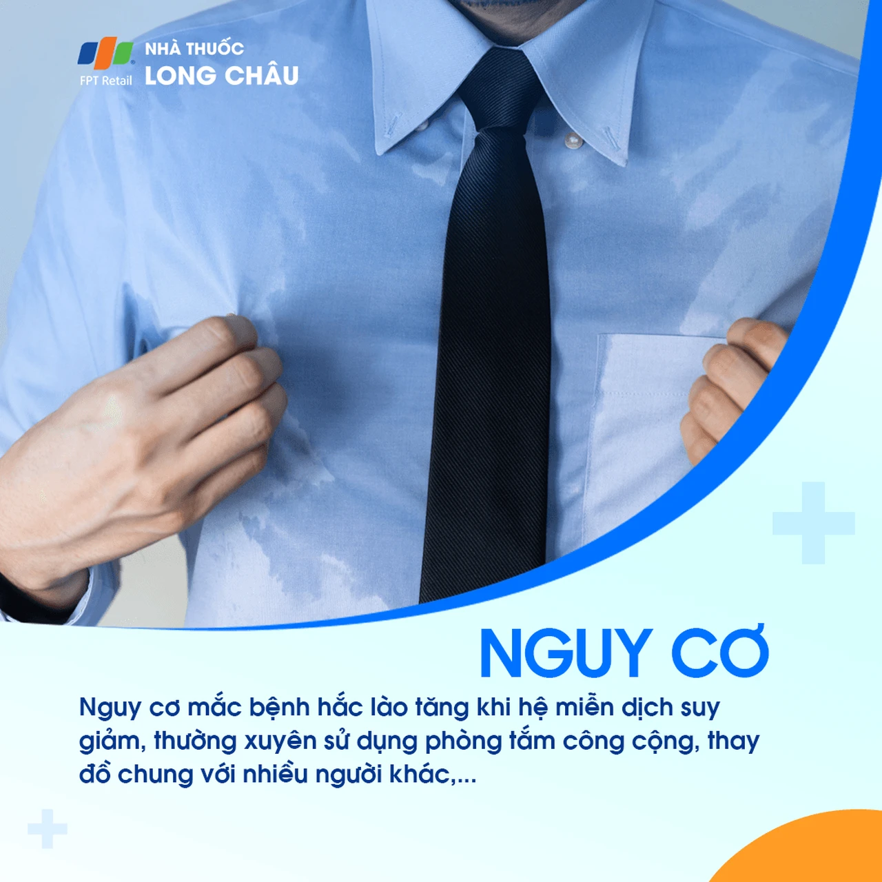 Hình ảnh minh họa