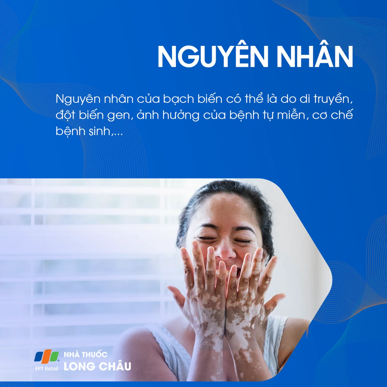 Hình ảnh minh họa