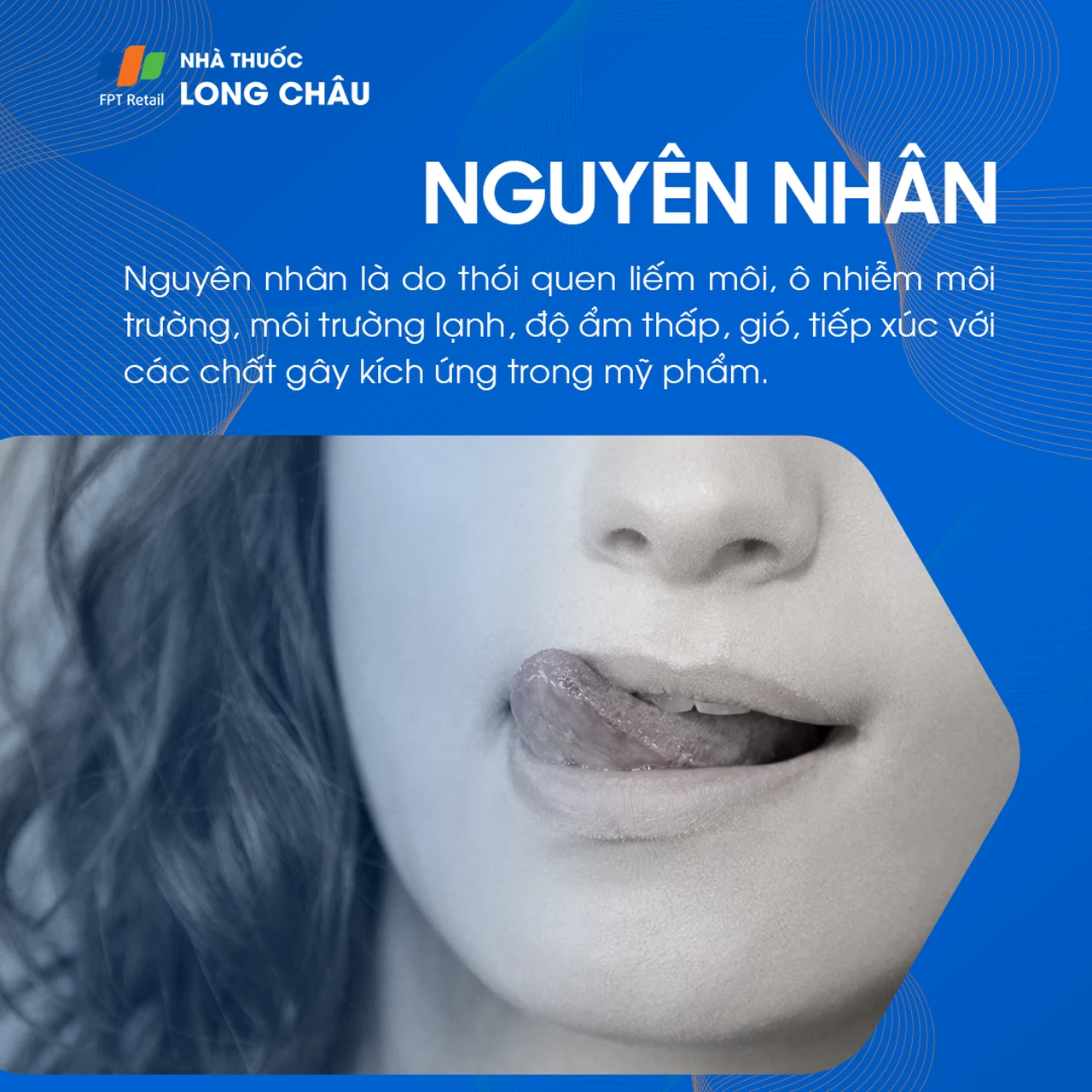 Hình ảnh minh họa