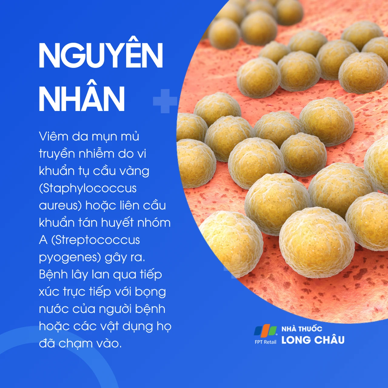 Hình ảnh minh họa
