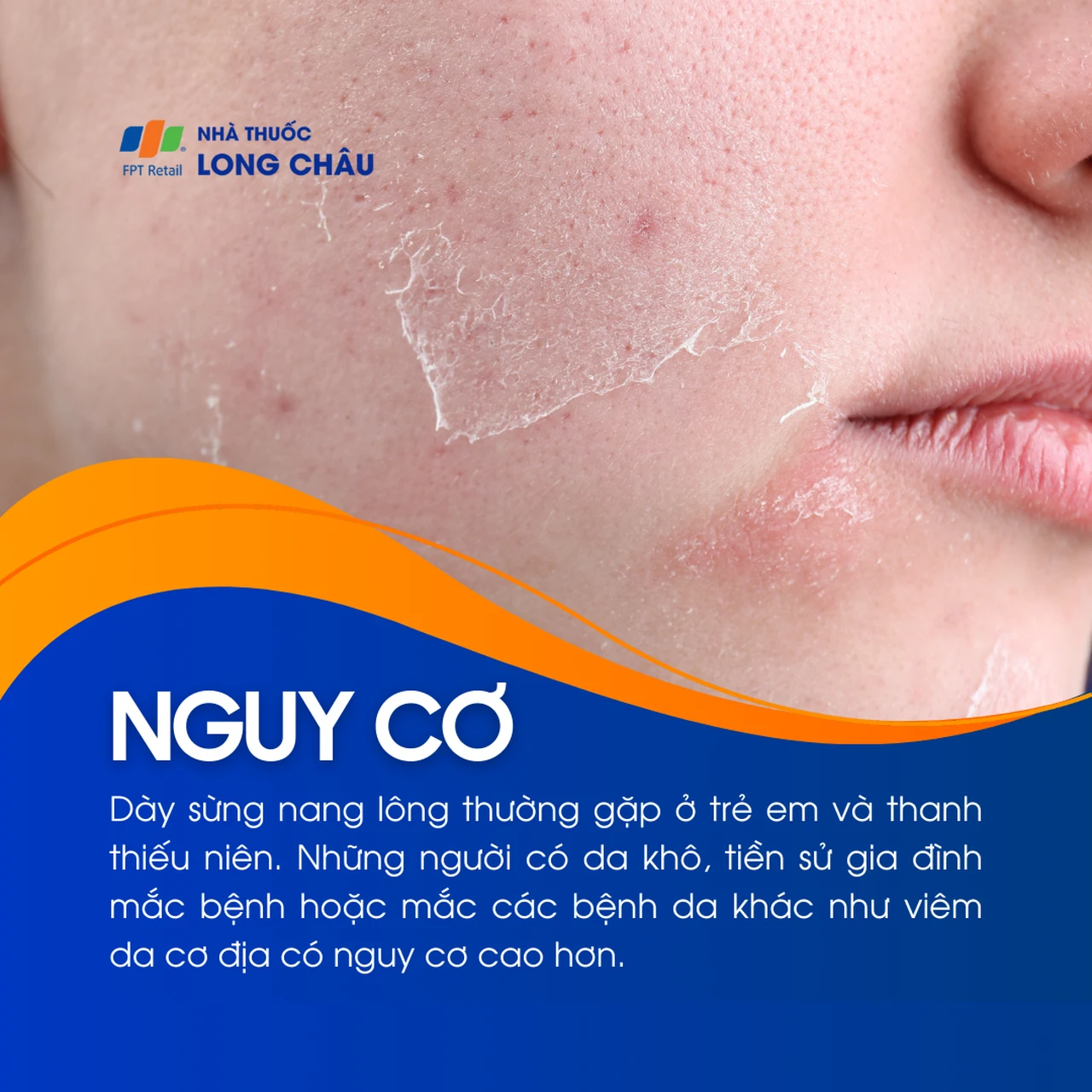 Hình ảnh minh họa