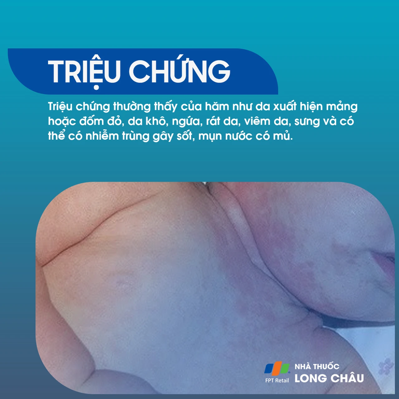 Hình ảnh minh họa