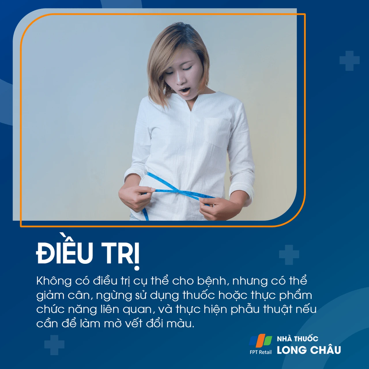Hình ảnh minh họa