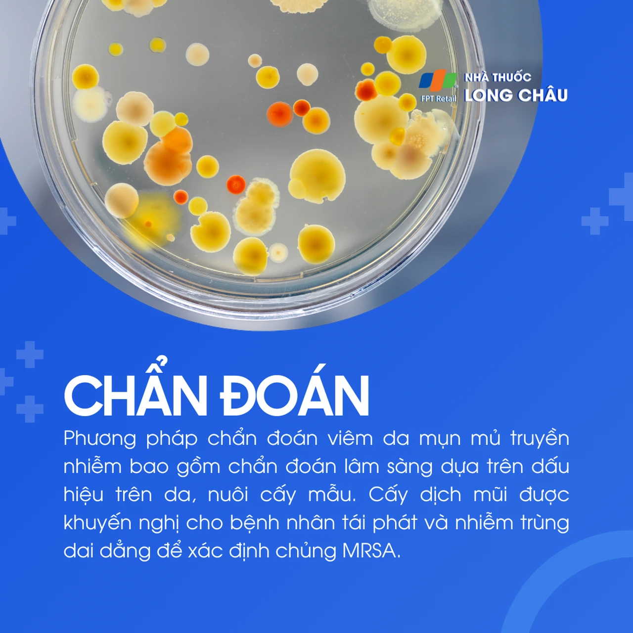 Hình ảnh minh họa