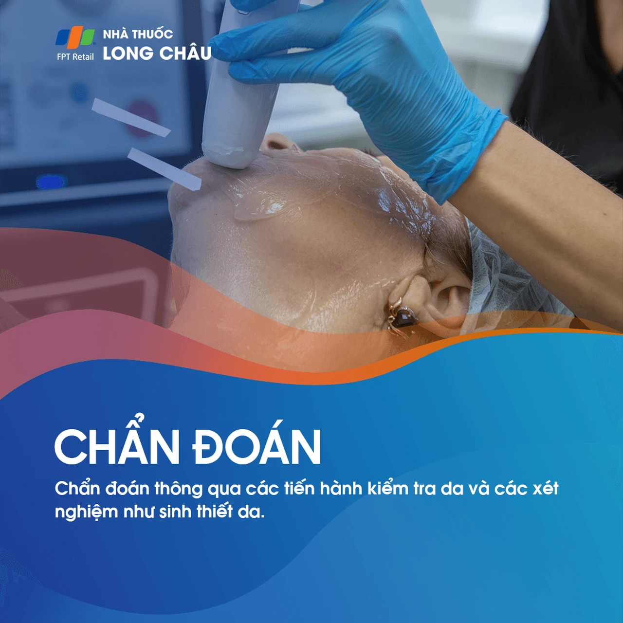 Hình ảnh minh họa
