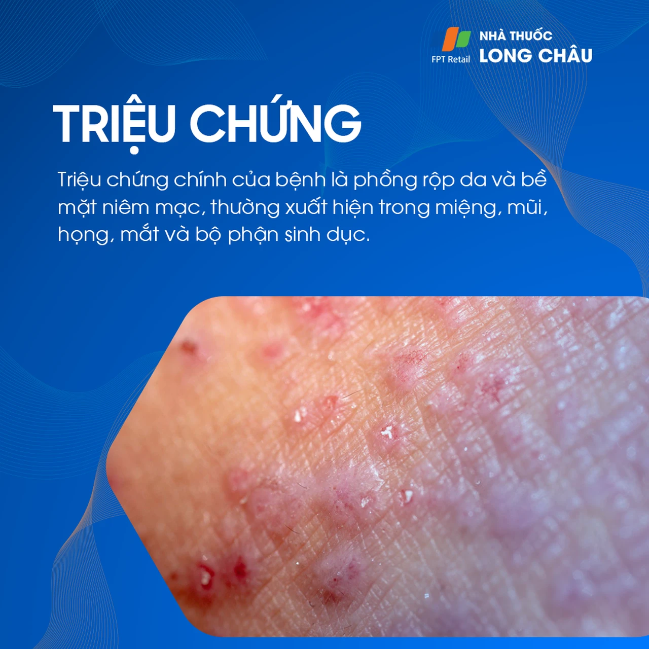 Hình ảnh minh họa