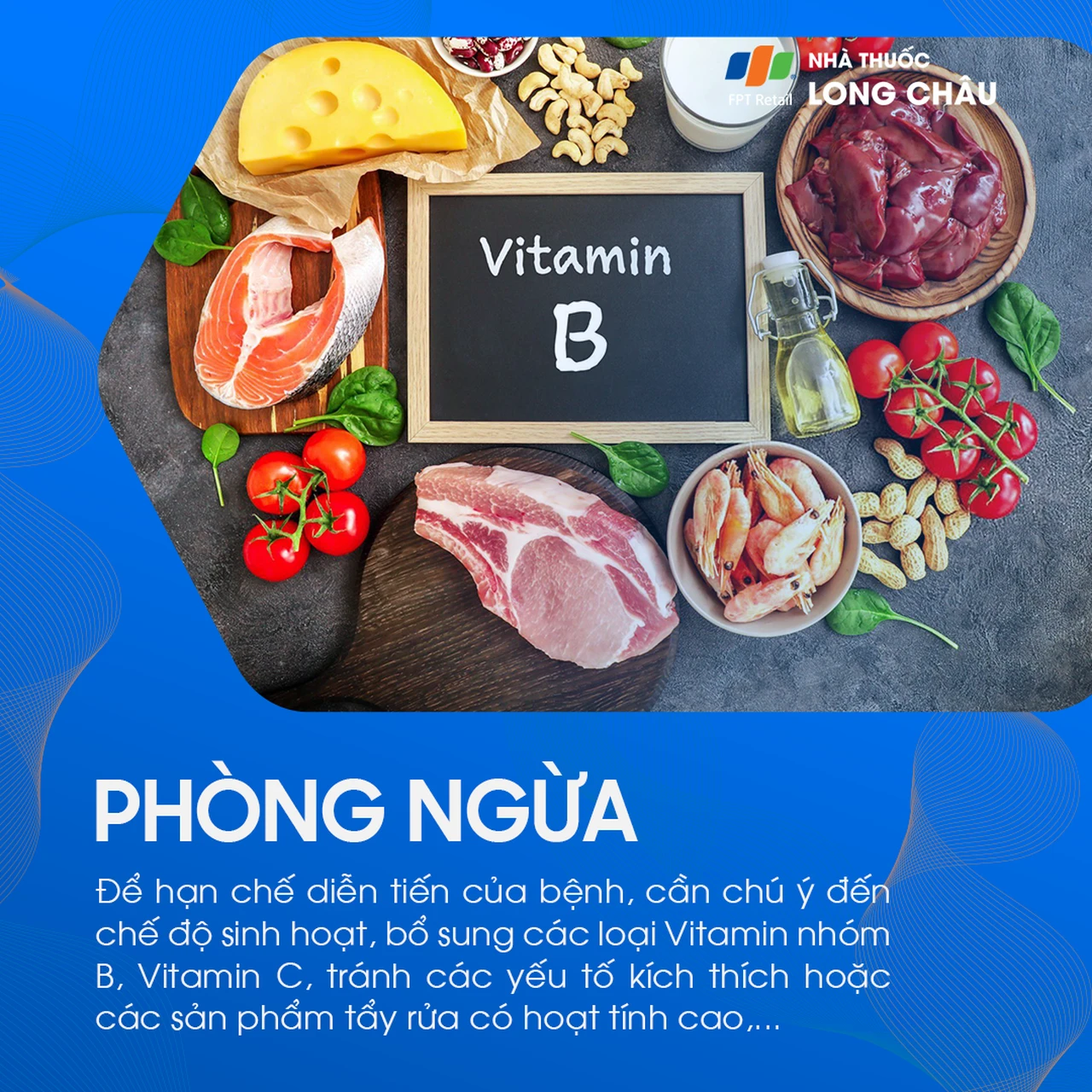 Hình ảnh minh họa