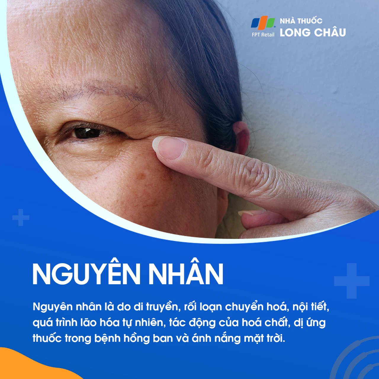 Hình ảnh minh họa
