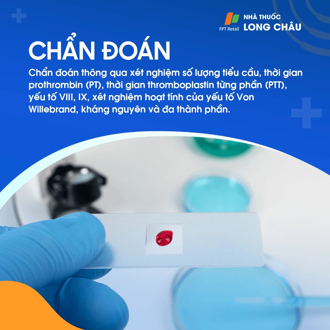Hình ảnh minh họa
