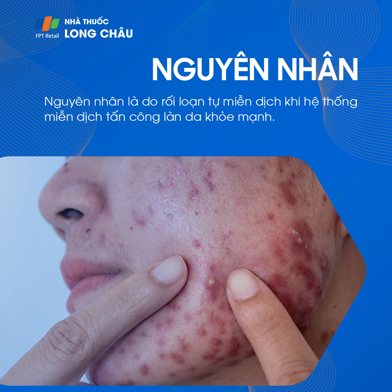 Hình ảnh minh họa
