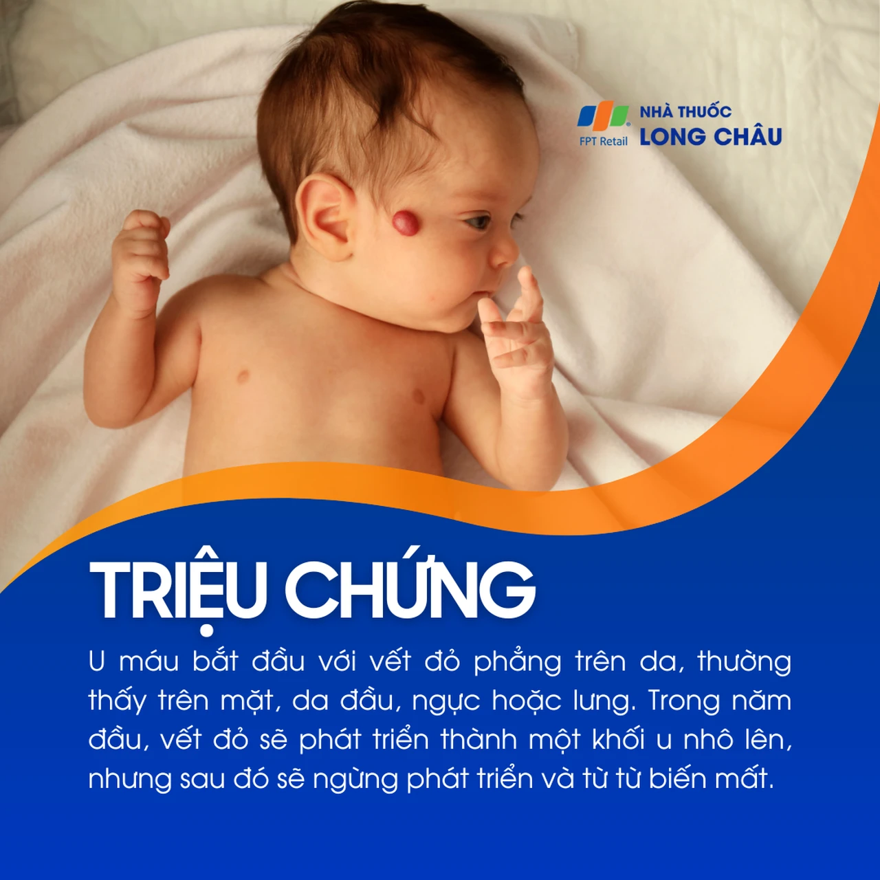 Hình ảnh minh họa