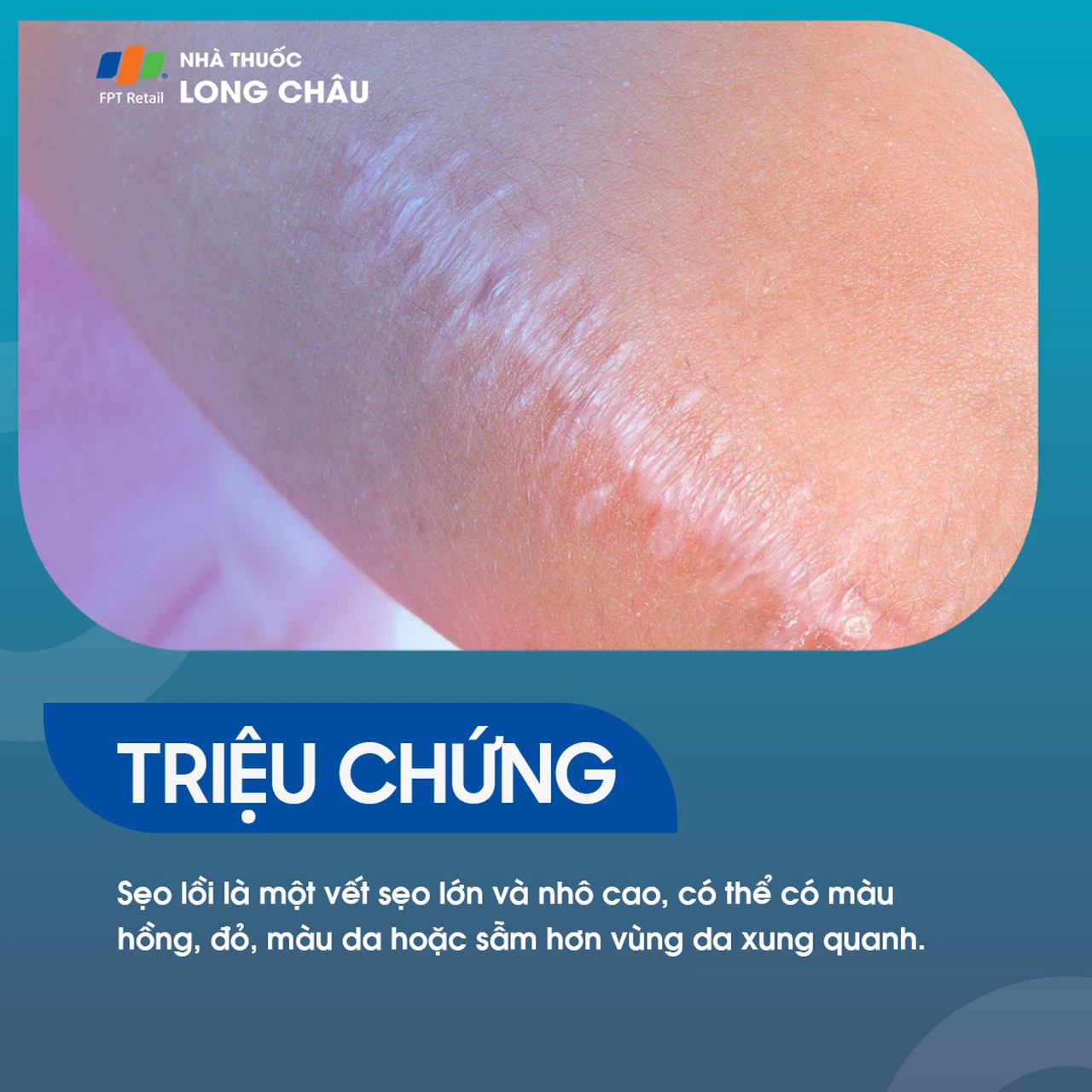 Hình ảnh minh họa
