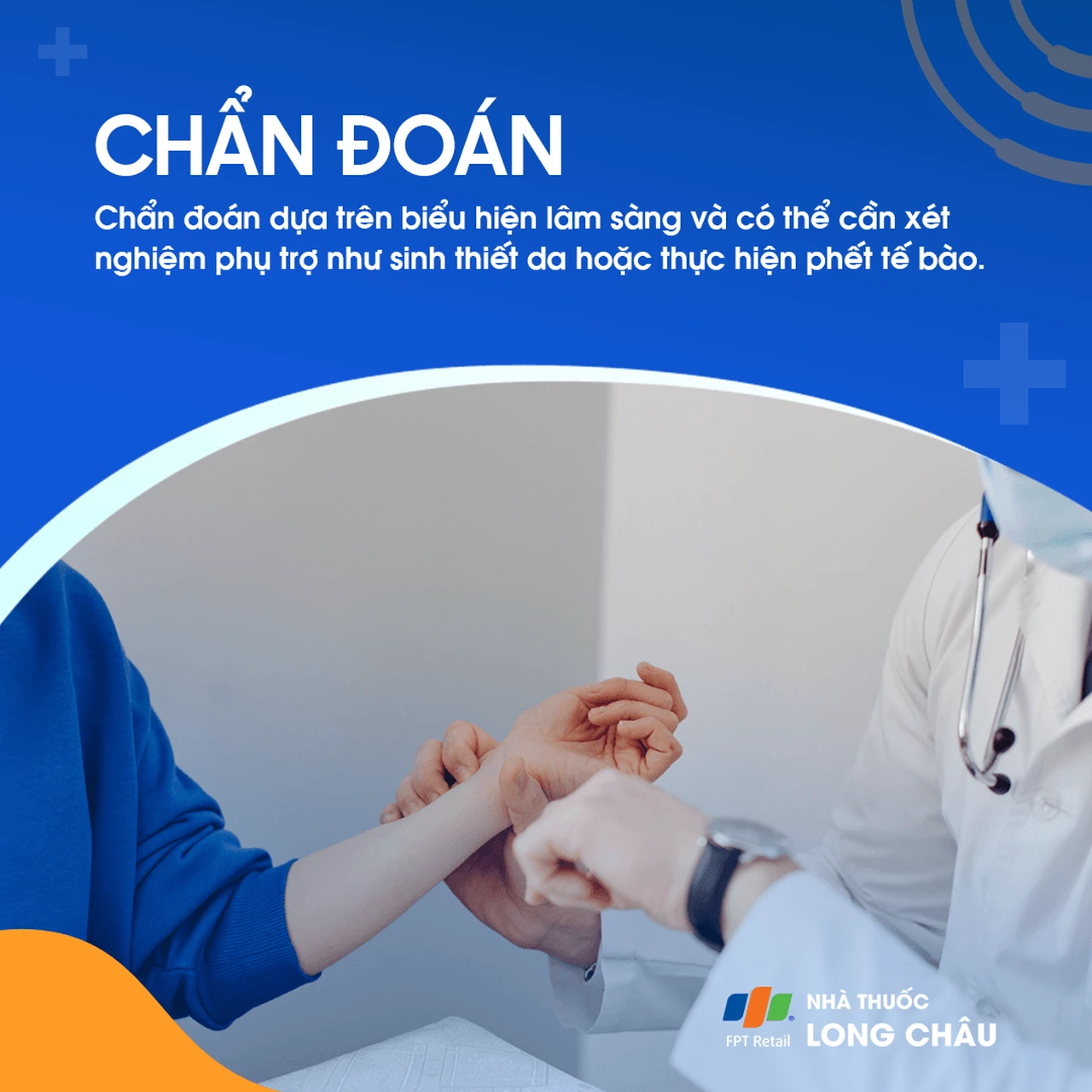 Hình ảnh minh họa