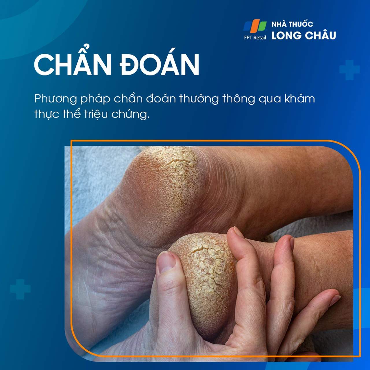 Hình ảnh minh họa