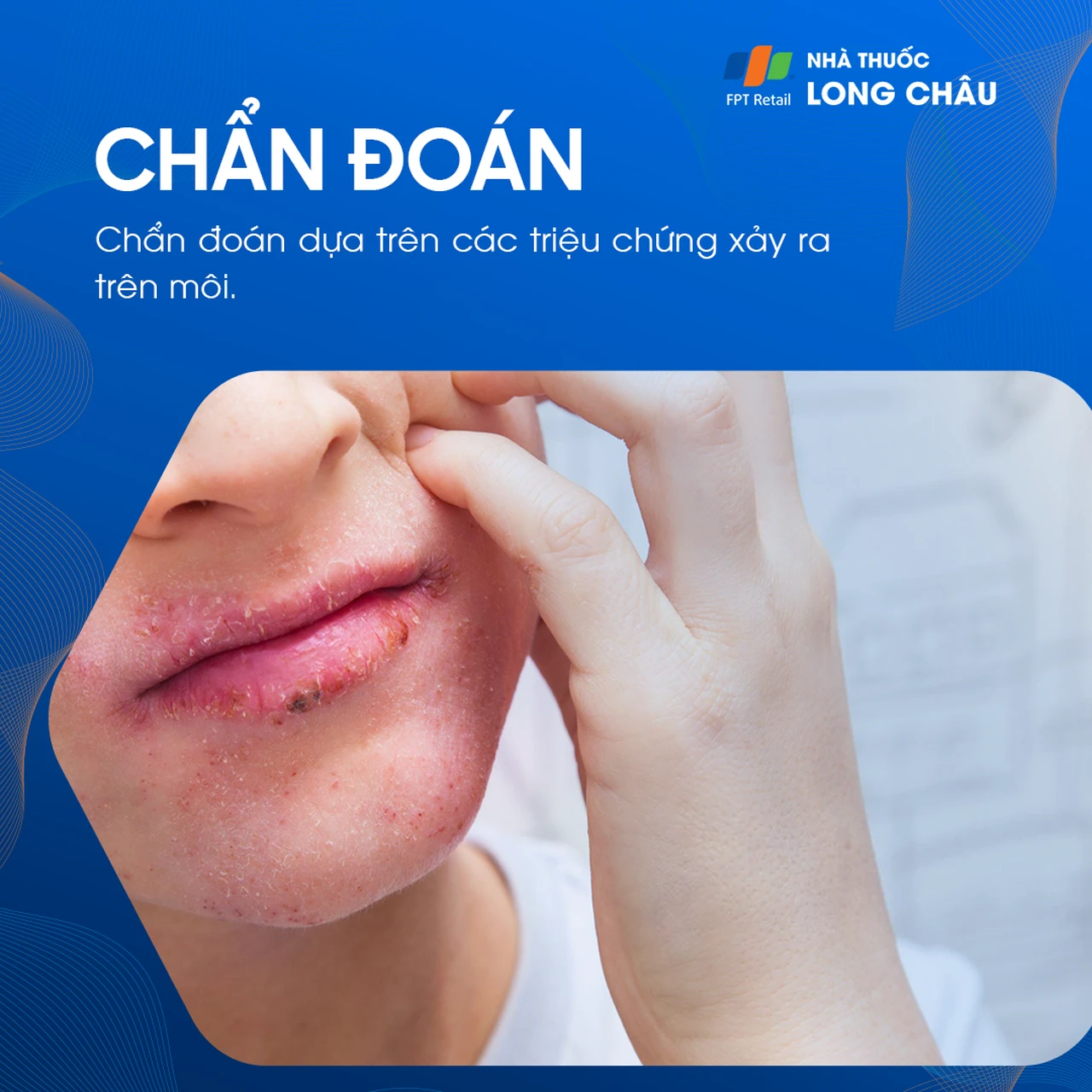 Hình ảnh minh họa