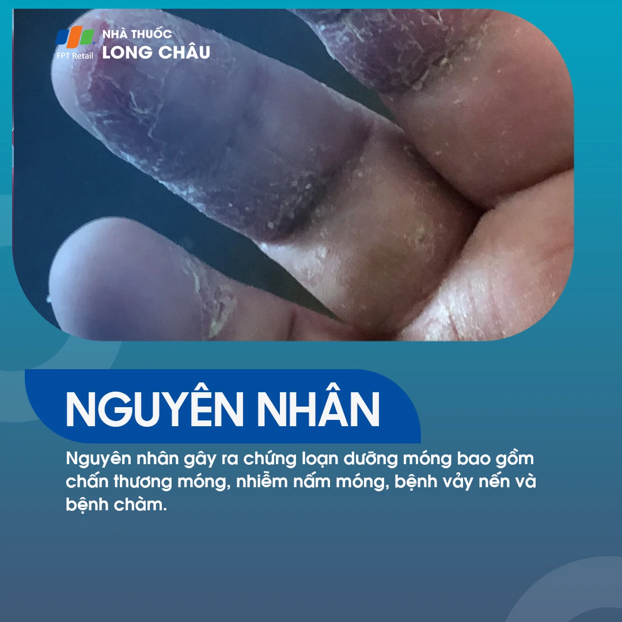 Hình ảnh minh họa