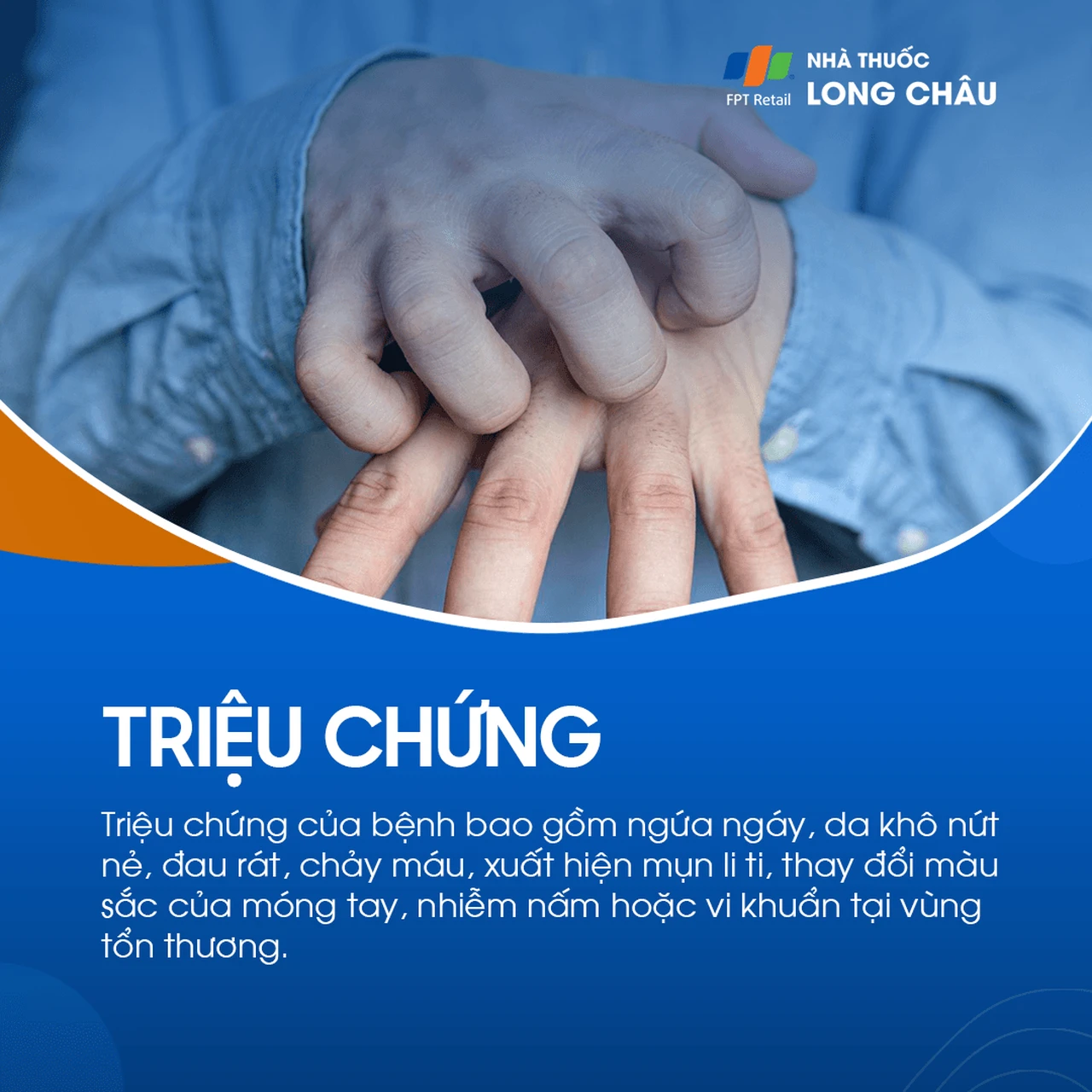 Hình ảnh minh họa