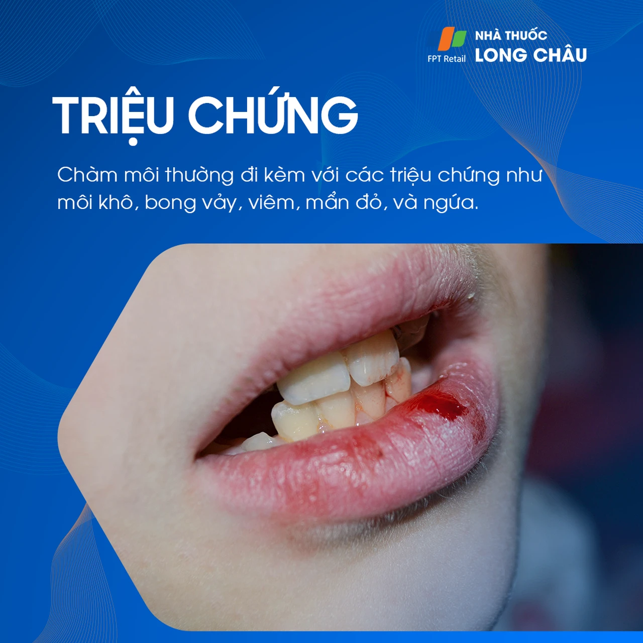Hình ảnh minh họa