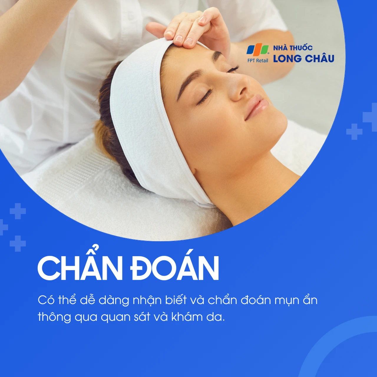 Hình ảnh minh họa