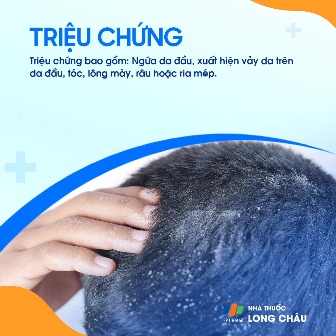 Hình ảnh minh họa