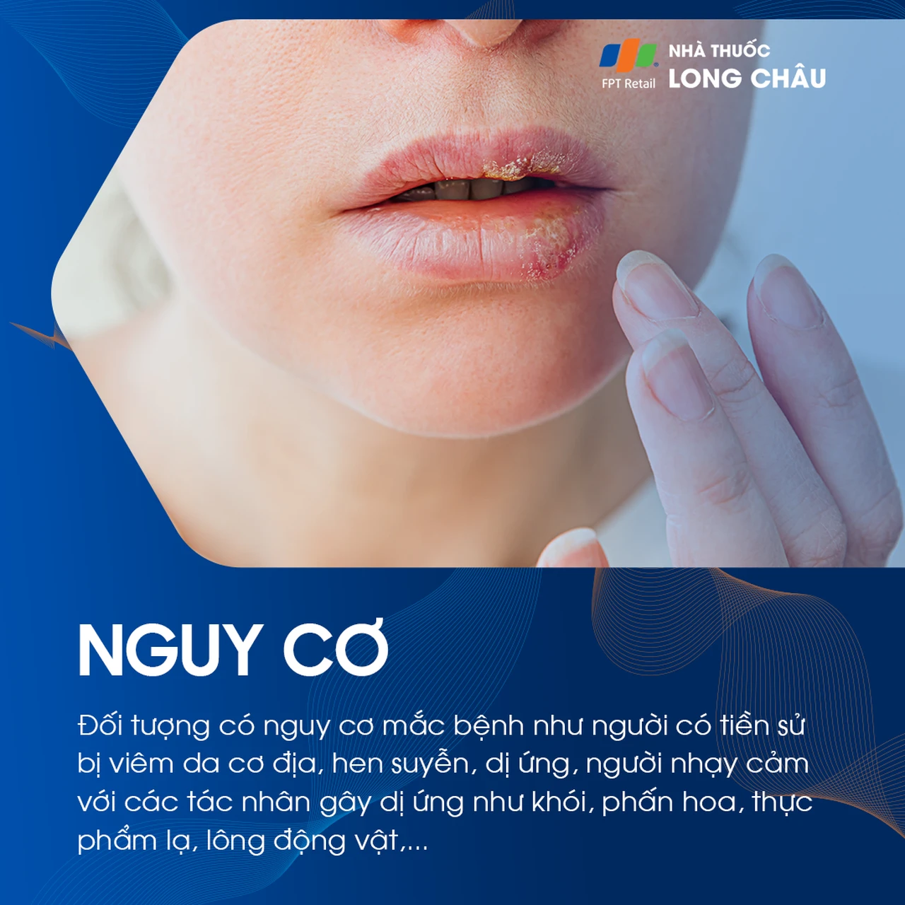 Hình ảnh minh họa