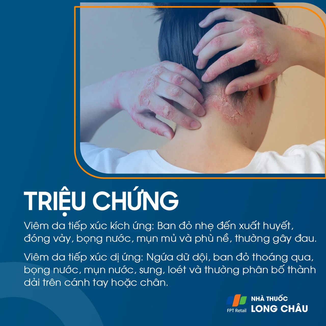 Hình ảnh minh họa