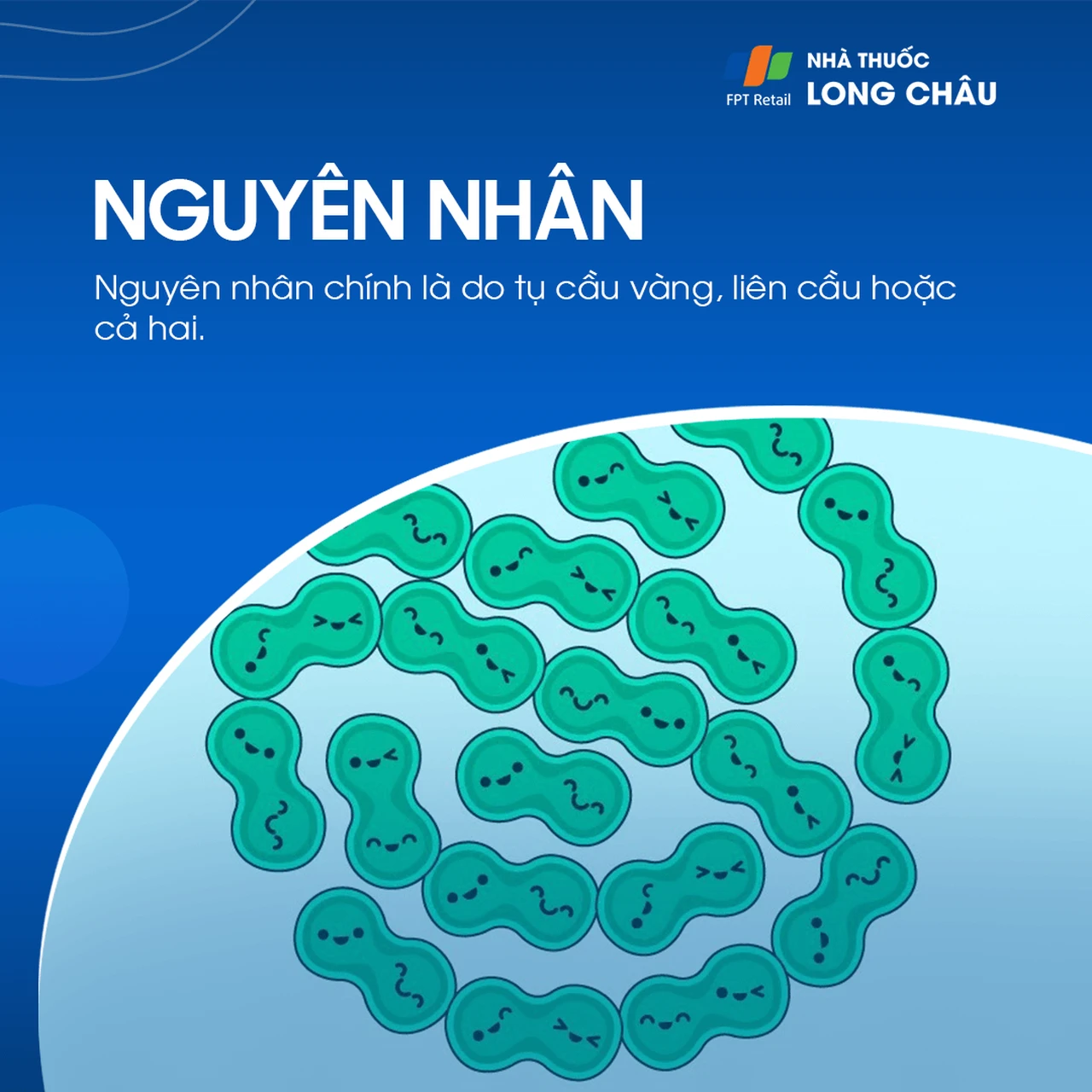 Hình ảnh minh họa