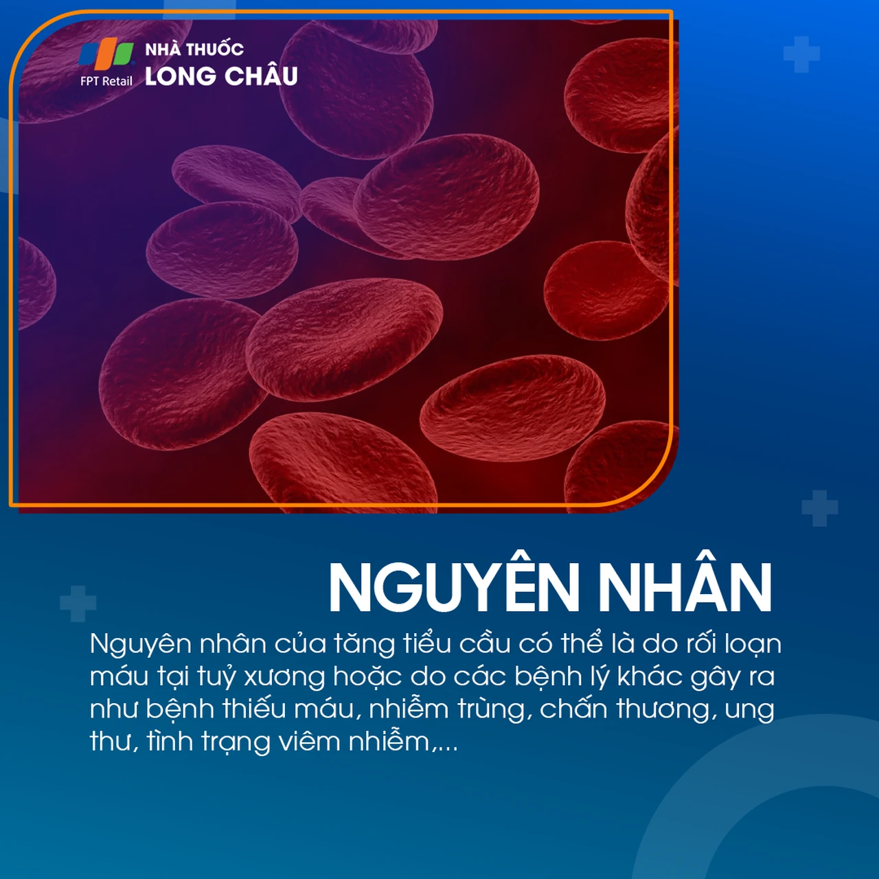 Hình ảnh minh họa